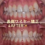 スタッフの矯正記録まとめ(^o^)