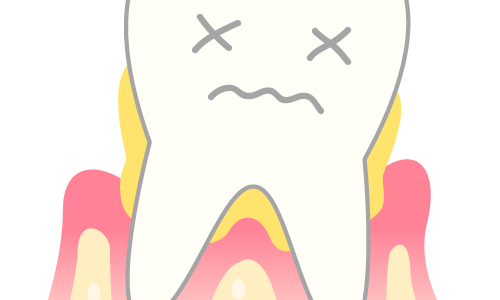 歯を失った場合は？