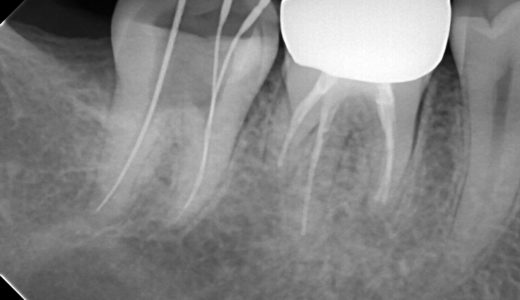 歯科医院におけるレントゲン