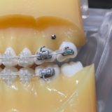 バイトアップとは