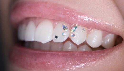 ティースジュエリーとは？歯につけるジュエリーの魅力と料金