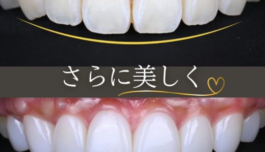 ブラックフィルム✨