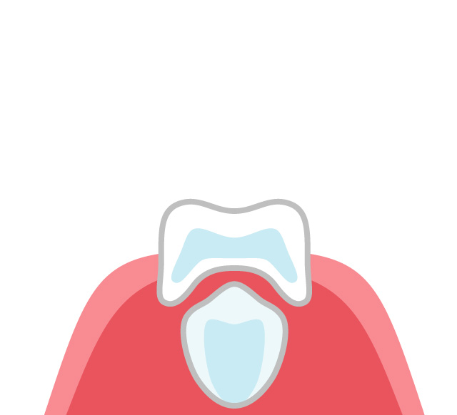生えかわりの仕組みとその時期
