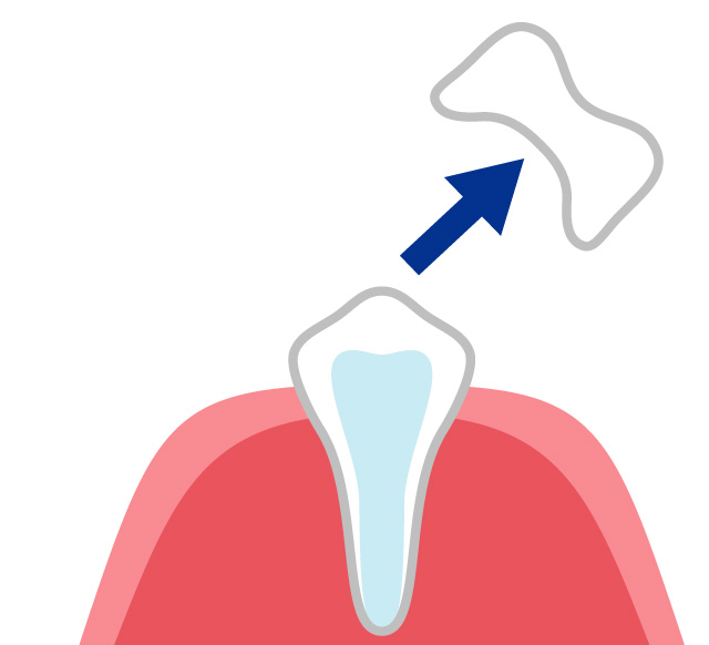 生えかわりの仕組みとその時期