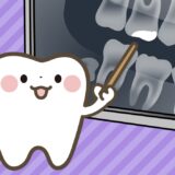 歯医者のレントゲンって大丈夫？