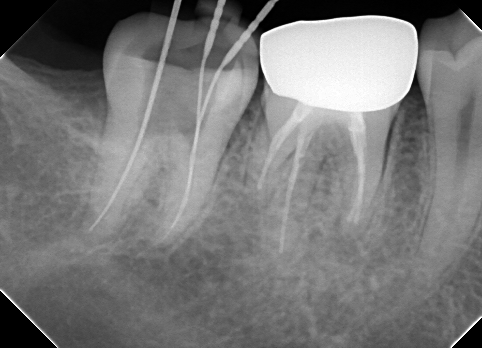 歯科医院におけるレントゲン - 名駅アール歯科・矯正歯科