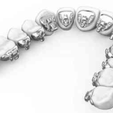 裏側矯正のメリット