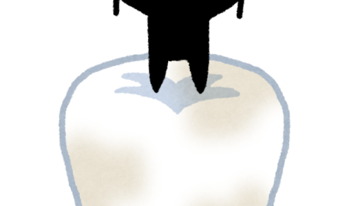 むし歯はこうやってできる